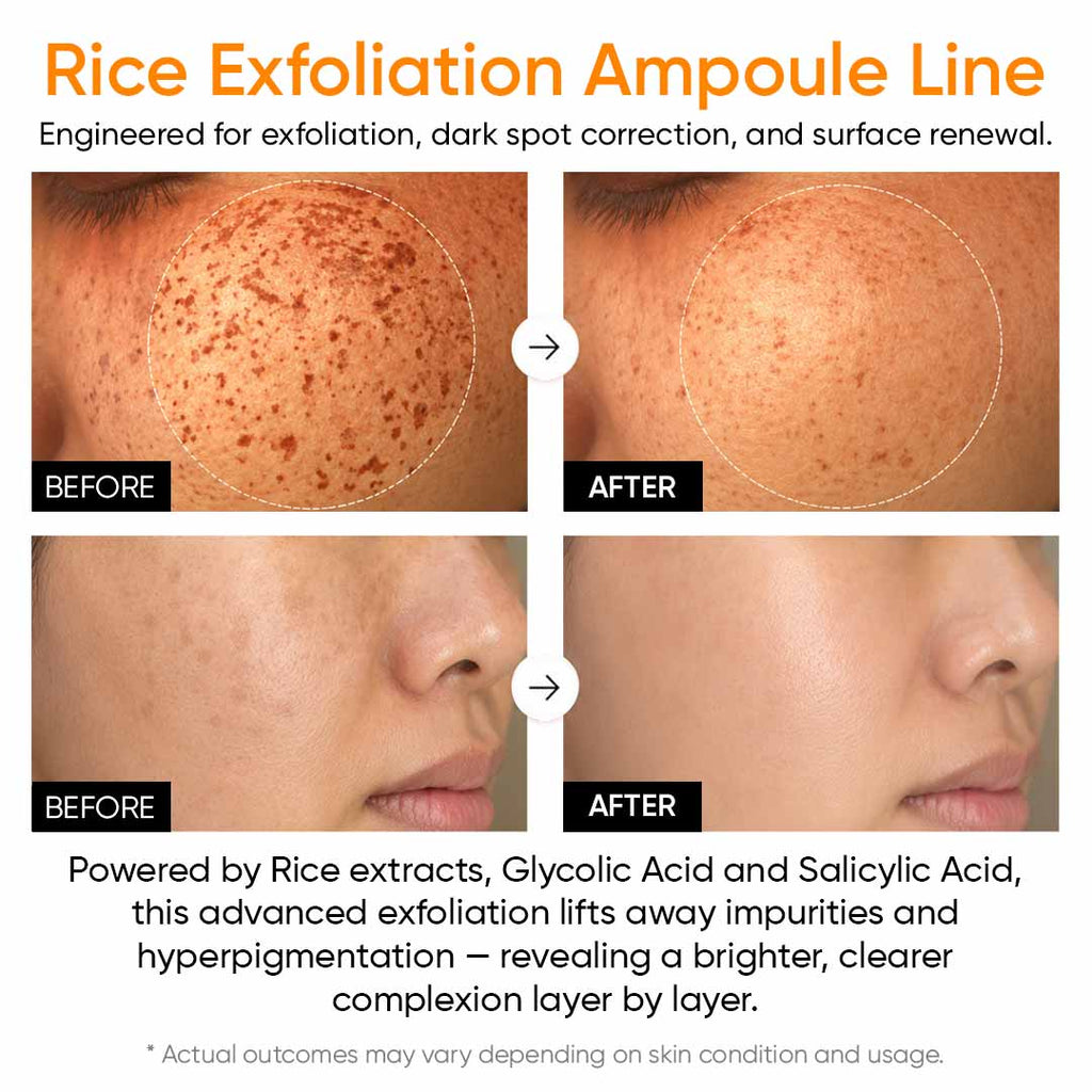 SANUO Black & White Rice Ampoule Duo | Korean Exfoliating Set