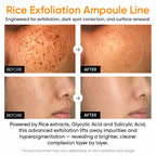 SANUO Black & White Rice Ampoule Duo | Korean Exfoliating Set